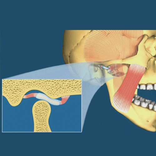 implantologia-studio-donadio-napoli-dentista