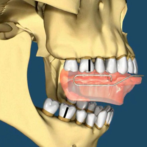 impiantologia-studio-donadio-napoli-ortopedia