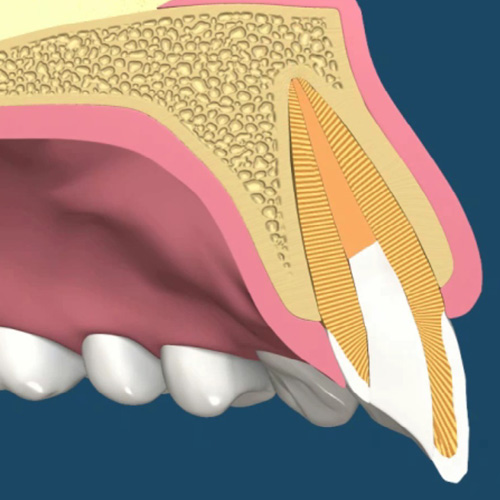 implantologia-studio-donadio-napoli-endodonzia