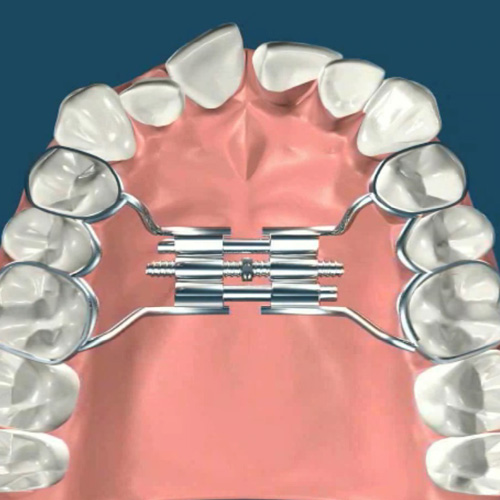 implantologia-studio-donadio-napoli-infantile-odontoiatria