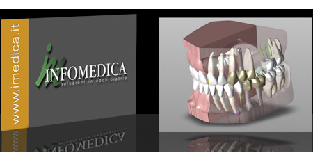 studio-dentistico-donadio-napoli-dentista-salerno-torre-annunziata-andi-campania-sbiancamento-estetica