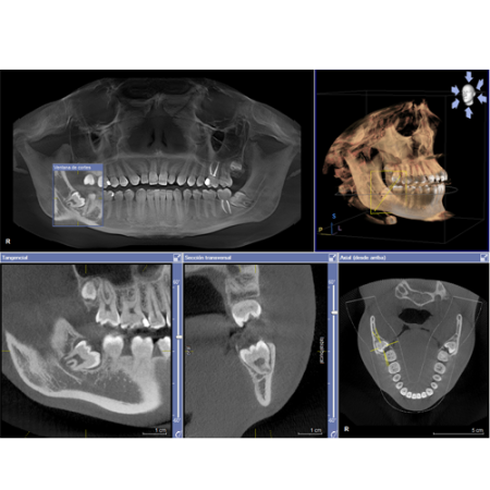 studio-dentistico-donadio-napoli-dentista-salerno-torre-annunziata-andi-campania-sbiancamento-radiologia02