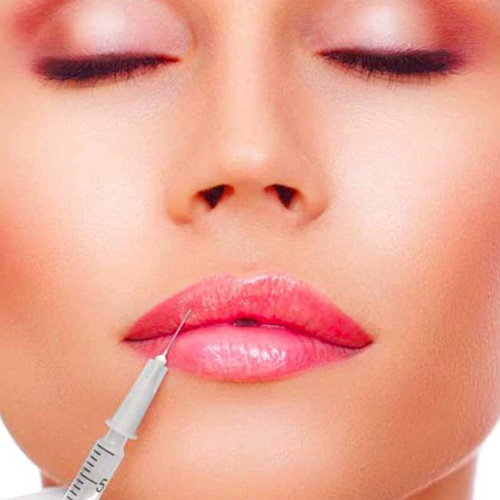 impiantologia-studio-donadio-napoli-filler