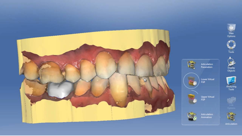 Il sistema Cerec nel suo funzionamento in dettaglio